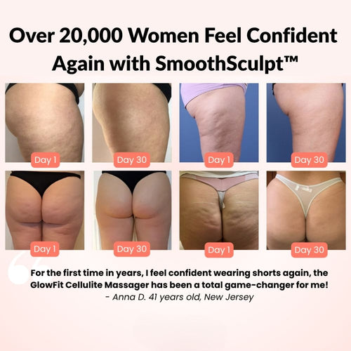 SmoothSculpt™ Heated Vacuum Massager